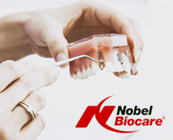 Implantes Nobel Biocare
